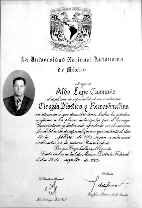 UNAM-TITULO-ALDO
