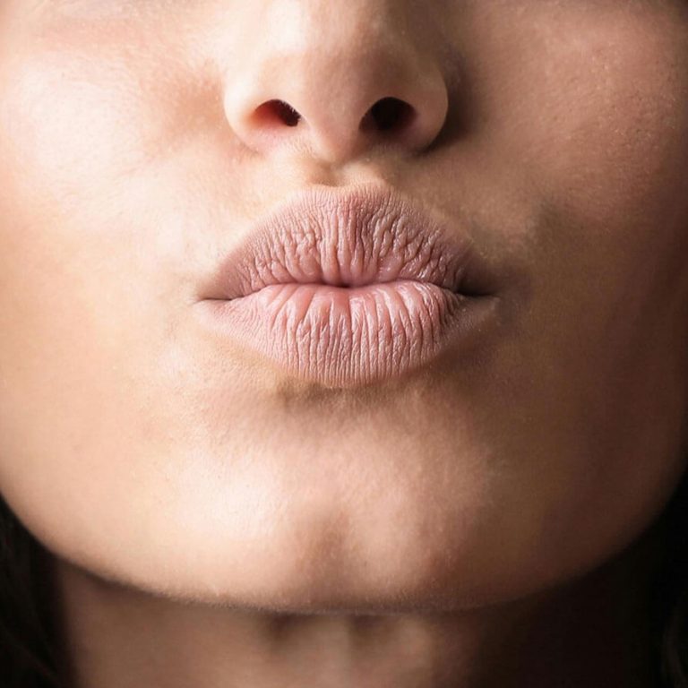 Lip_Lifting-AL_1